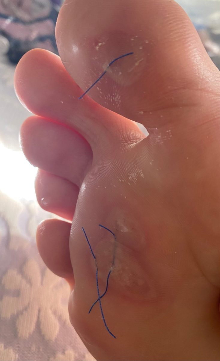 Surgeon or Seamstress